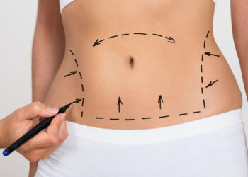 Cirurgião plástico explica sobre os cuidados para cirurgia plásticas no verão