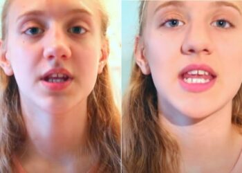 Cigarro eletrônico: após 5 anos de vape, mulher de 20 anos descobre que pulmões falharam e não vai passar dos 40