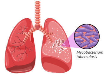 Dia Mundial da Tuberculose: conscientização e diagnóstico precoce são fundamentais para a prevenção e controle da doença