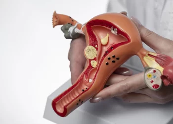 Miomas uterinos: hemodinâmica permite tratamento eficaz e minimamente invasivo