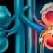 Cálculo renal: hábitos no inverno aumentam a incidência dos casos