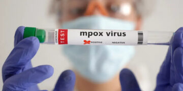 Tailândia confirma primeiro caso de nova variante da mpox