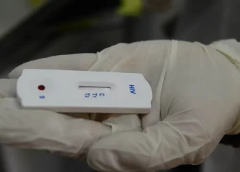 Saúde orienta farmácias sobre testes para HIV, sífilis e hepatites