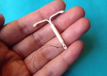 DIU aumenta risco de câncer de mama? Novo estudo indica quando o método contraceptivo pode representar ameaça
