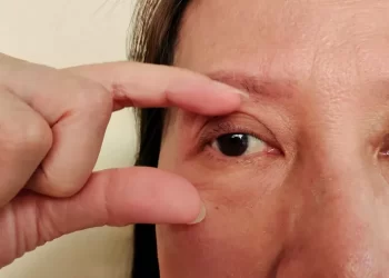 Cegueira silenciosa: doenças que ameaçam a visão de milhões são preveníveis