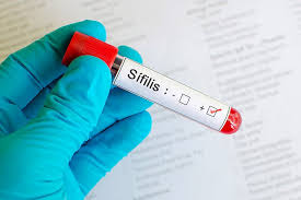 Diagnóstico precoce é fundamental para restringir o avanço da sífilis