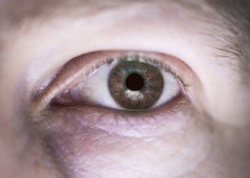 Brasil é campeão mundial em cirurgia nas pálpebras