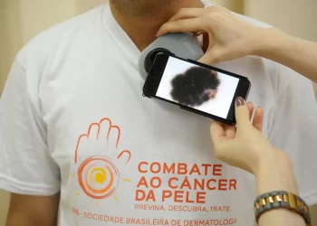 Mutirão atende população hoje, no dia de combate ao câncer de pele