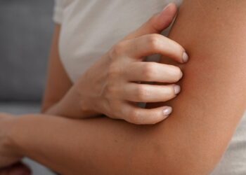 Dengue: além da febre, confira outros impactos da doença no corpo humano