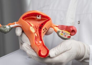 Março Amarelo: Especialista destaca avanços no tratamento da endometriose