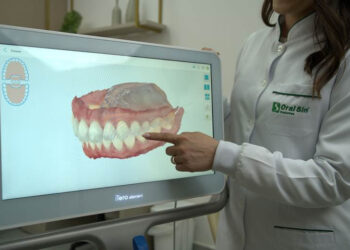 Tecnologia eleva o sucesso dos implantes dentários