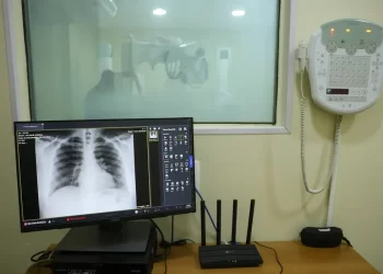 Fiocruz alerta para alta nas internações por Influenza A no Brasil