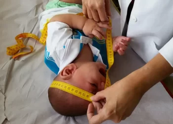 INSS pagará indenização de R$ 60 mil a crianças com deficiência causada pelo vírus Zika