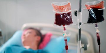 Transplante de medula óssea pode curar leucemia