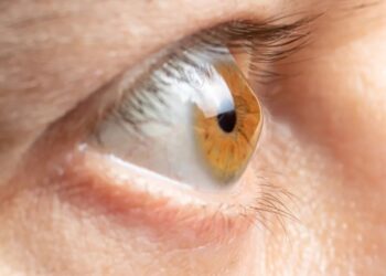 Coçar os olhos pode levar a um grave prejuízo na visão, alerta SGO