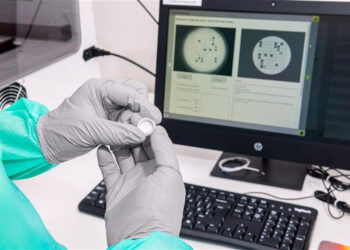 Papanicolau é substituído no SUS por teste que consegue detectar o HPV com até 10 anos de antecedência ao desenvolvimento de lesões