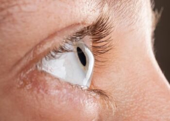 Junho Violeta: Especialista alerta para a prevenção da ceratocone e esclarece dúvidas sobre a doença