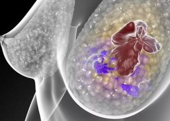 Câncer de mama triplo negativo metastático: pacientes e especialistas debatem jornada e decisão compartilhada no 12º TJCC