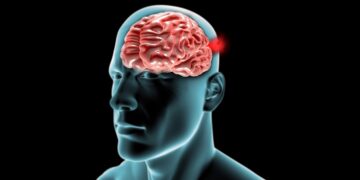 Associação cobra visibilidade para a Síndrome da Fadiga Crônica em audiência sobre a Lei da Fibromialgia