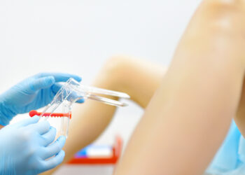 SUS avança na prevenção do câncer do colo do útero com novo teste de DNA-HPV