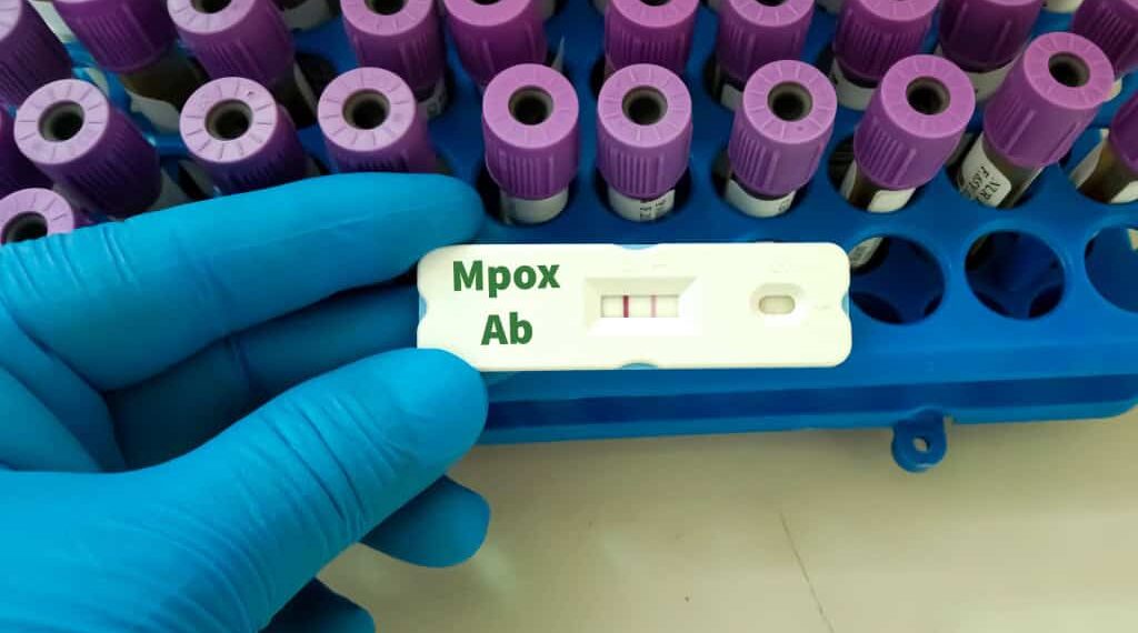 Os três vírus que podem desencadear novas crises em 2026