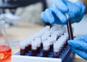 Exame de sangue em teste no Brasil pode ajudar a detectar câncer de mama