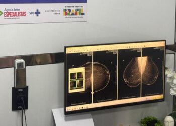 Carretas da Saúde da Mulher ampliam atendimento especializado do SUS em Brumado e Valença