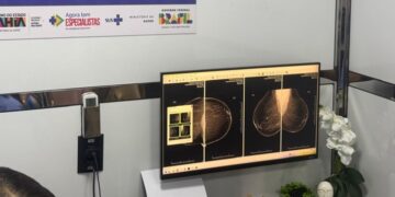 Carretas da Saúde da Mulher ampliam atendimento especializado do SUS em Brumado e Valença