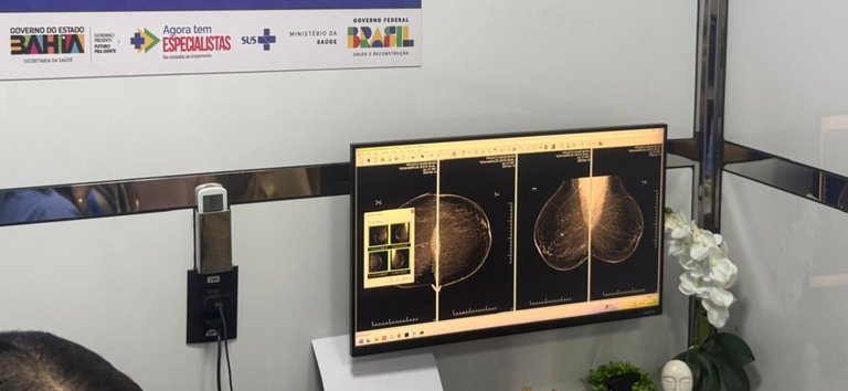 Carretas da Saúde da Mulher ampliam atendimento especializado do SUS em Brumado e Valença