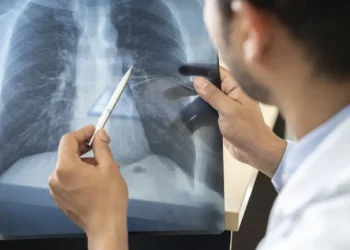 Tabagismo é maior entre jovens de 16 a 24 anos, alerta pesquisa