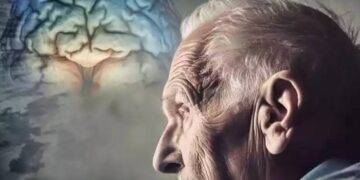 O Alzheimer começa a se formar até 20 anos antes do primeiro esquecimento