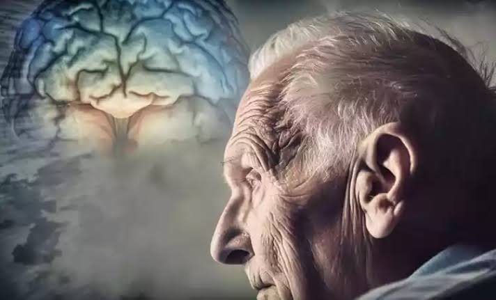 O Alzheimer começa a se formar até 20 anos antes do primeiro esquecimento