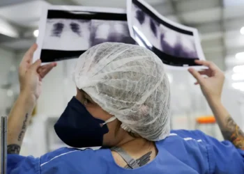 Número de casos de SRAG segue em queda na maior parte do país