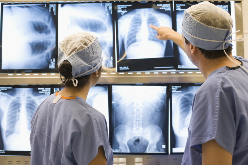 Diagnóstico precoce e cirurgia minimamente invasiva transformam o tratamento do câncer de pulmão no Brasil