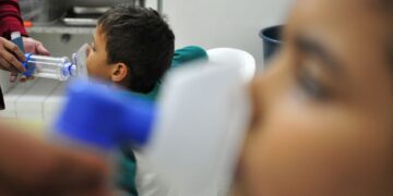 Cresce número de casos de SRAG em crianças e adolescentes no país