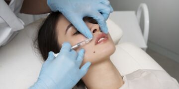 Anvisa alerta para riscos de preenchedores fora das indicações; médico explica quando procedimento estético deve ser evitado