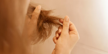 Queda de cabelo pode ser sinal de deficiência de ferro? Médico explica