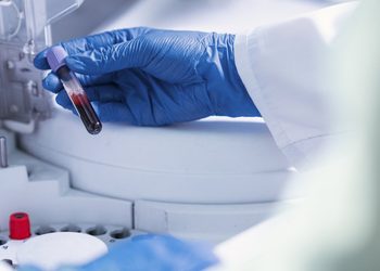 Exame de sangue para detectar Alzheimer chega ao Brasil