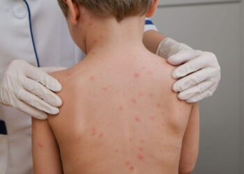 Dia Mundial da Meningite: Pesquisa global revela que só 19% dos pais e 10% dos jovens no Brasil sabem que a meningite meningocócica pode se tornar fatal em poucas horas