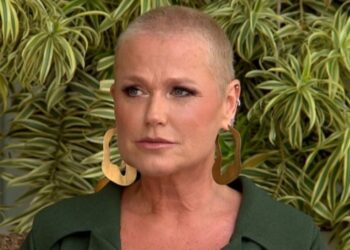 Saiba como a alopecia se manifesta
