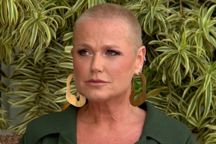 Saiba como a alopecia se manifesta